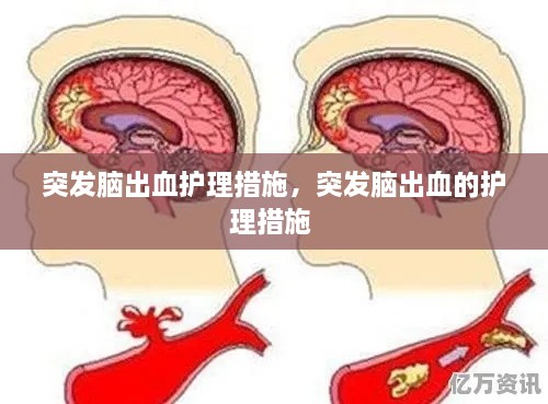 突發(fā)腦出血護理措施，突發(fā)腦出血的護理措施 