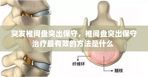 突發(fā)椎間盤(pán)突出保守，椎間盤(pán)突出保守治療最有效的方法是什么 