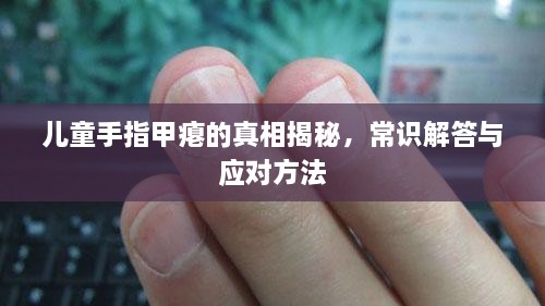 兒童手指甲癟的真相揭秘，常識解答與應(yīng)對方法