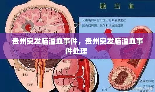 貴州突發(fā)腦溢血事件，貴州突發(fā)腦溢血事件處理 